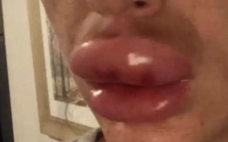 إلى النساء .. هذا ما فعله