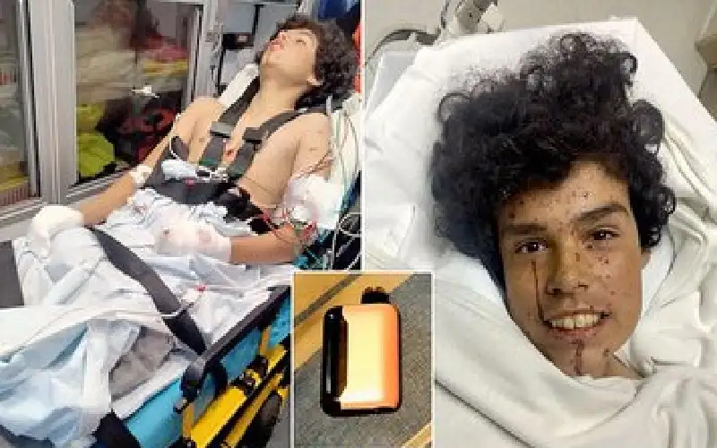 بترت أصابعه.. مصير مروع لمراهق بسبب