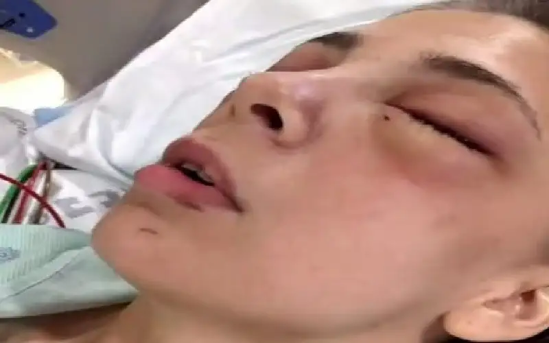 طالبة متفوقة تقتلع عينيها بيديها تحت