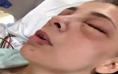 طالبة متفوقة تقتلع عينيها بيديها تحت