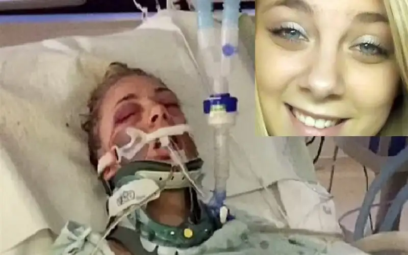 طالبة متفوقة تقتلع عينيها بيديها تحت