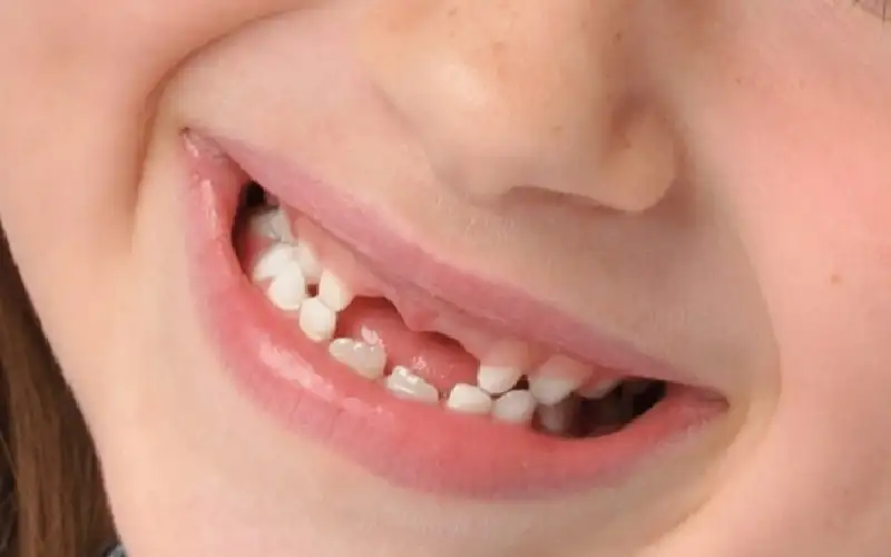 باحثون يابانيون يختبرون عقارا رائدا لإعادة