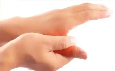 التواء الأصبع.. الأعراض والعلاج
