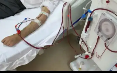 عطاء لزيادة عدد أسرة غسيل الكلى