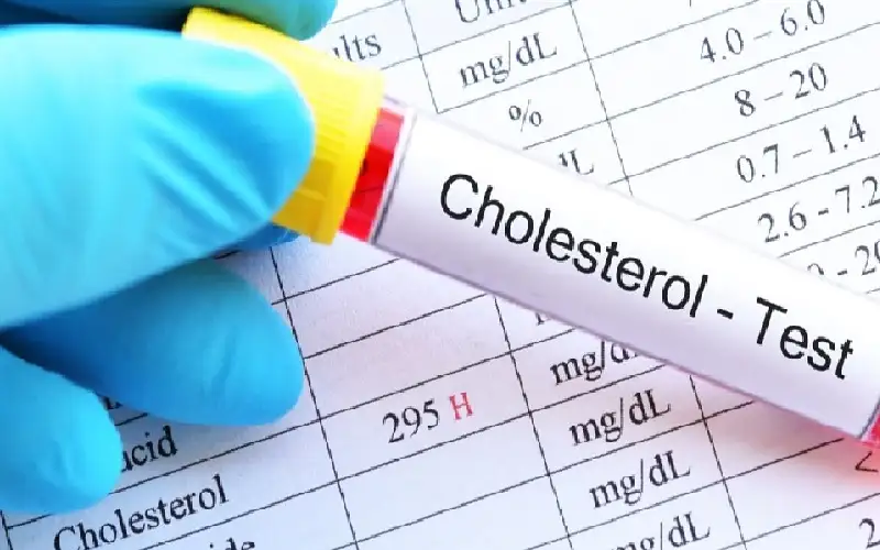 متى يكون الكوليسترول الجيد ضارا؟