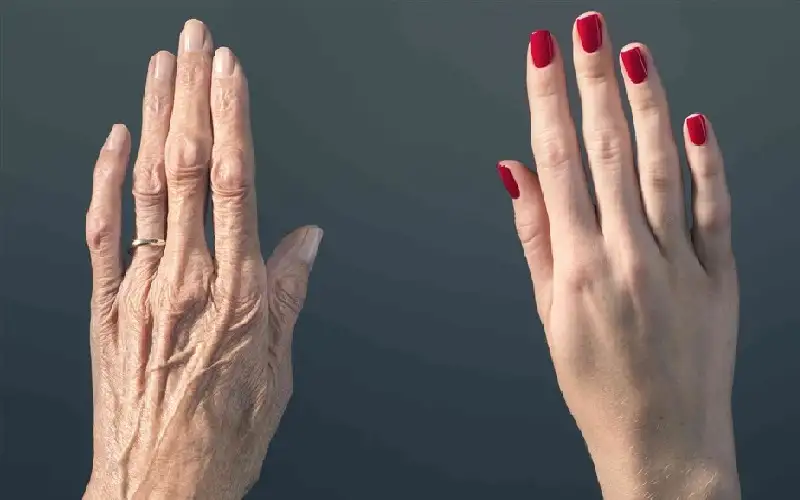 فترتان في العمر تتسارع فيهما الشيخوخة..