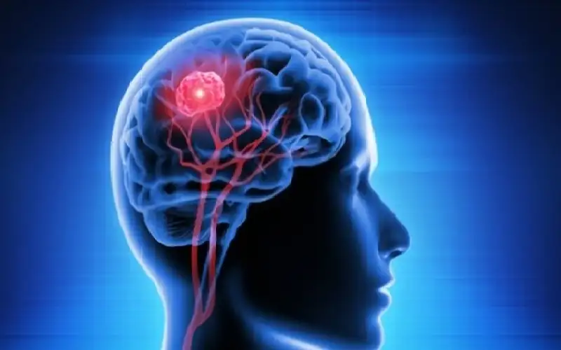 ظنتها أعراض الاستخدام المفرط للهاتف.. لتفاجأ