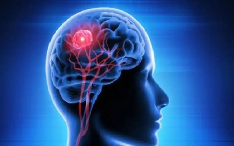 ظنتها أعراض الاستخدام المفرط للهاتف.. لتفاجأ