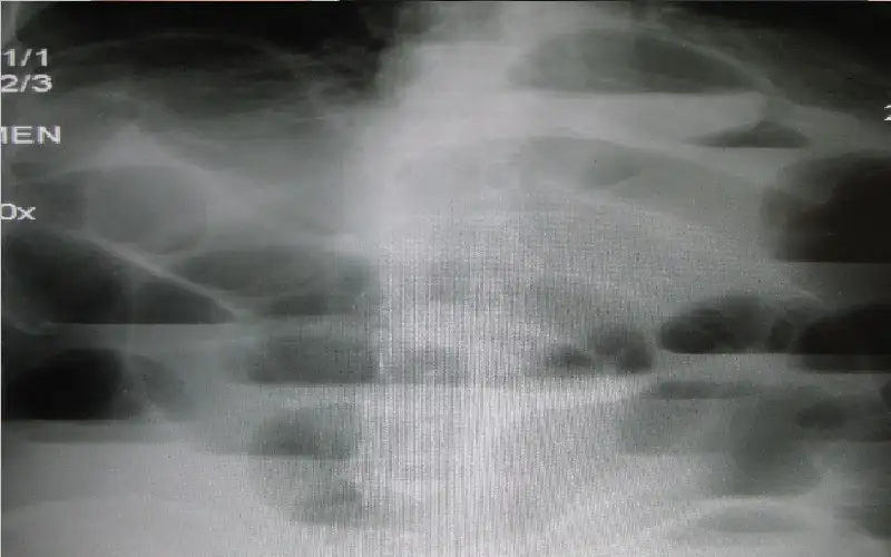 طبيب: هذا سبب ذهاب البعض إلى