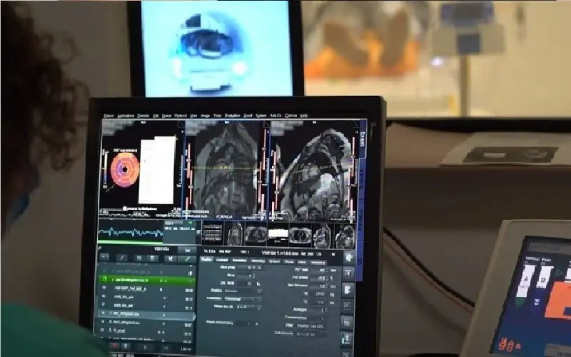 أداة ذكاء اصطناعي تتعرف على المصابين