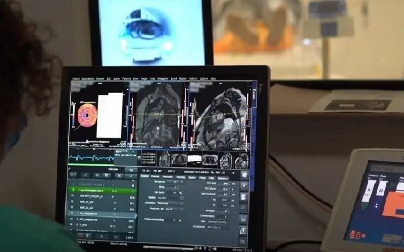 أداة ذكاء اصطناعي تتعرف على المصابين