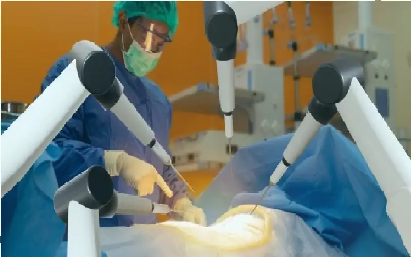 أول عملية جراحية بالروبوت المزدوج لإزالة