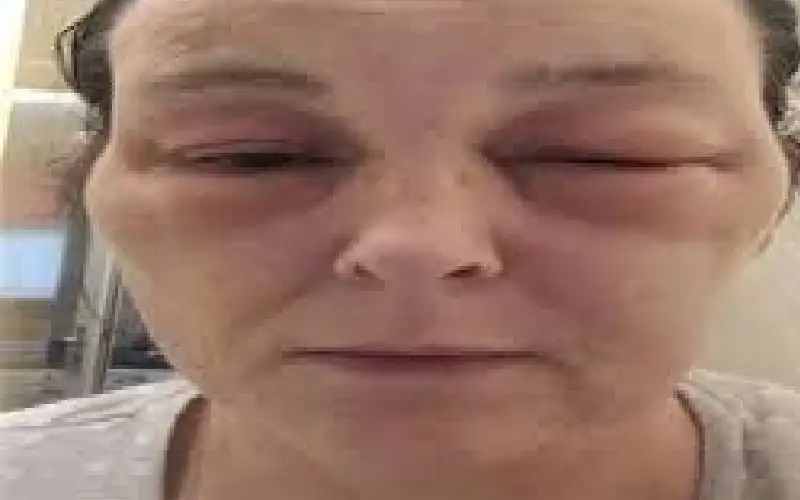 علامات مبكرة على قصور القلب يكشفها