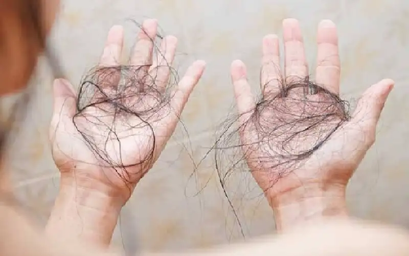 فضحها: صلعاء.. فانتقمت من زوجها بطفلهما