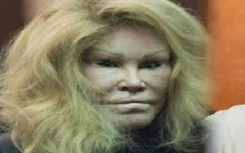 وفاة جوسلين وايلدنشتاين.. المرأة القطة التي