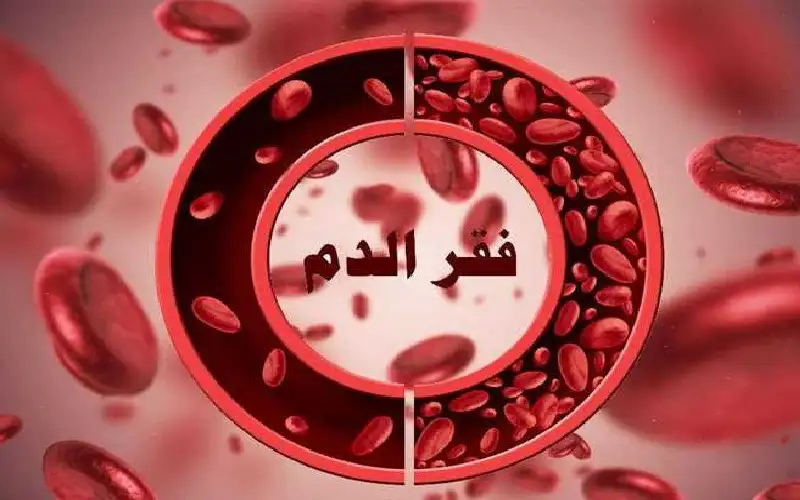 حقن الحديد أنجح في القضاء على