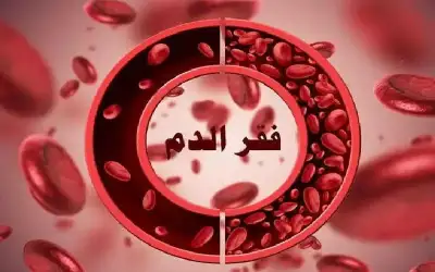 حقن الحديد أنجح في القضاء على