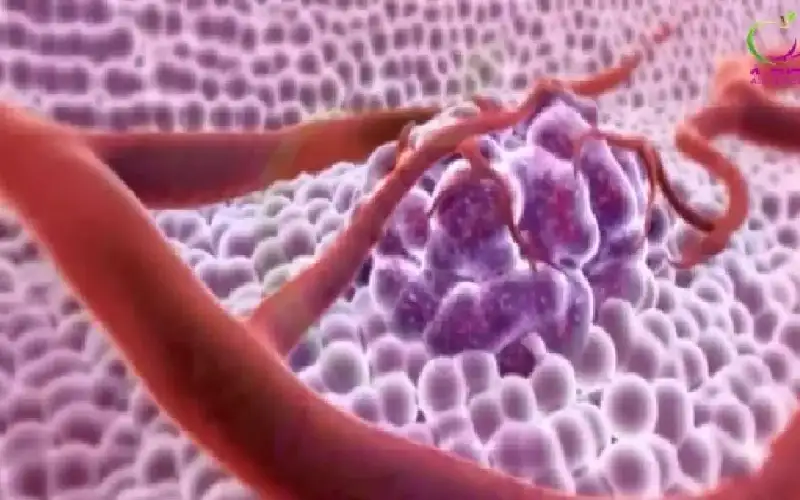 أم الجراحات.. عارضة أزياء تستأصل 8