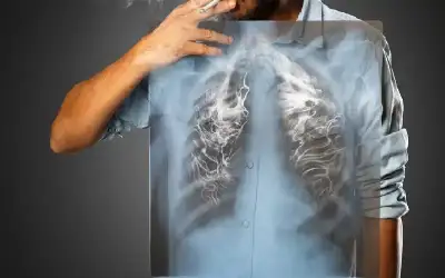 التدخين المبكر يفاقم مخاطر الانسداد الرئوي