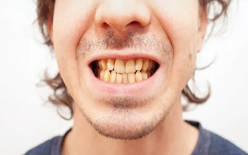 أي مشروب يترك بقعا أكثر على