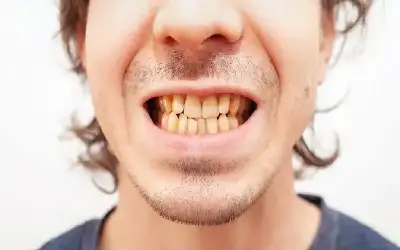 أي مشروب يترك بقعا أكثر على