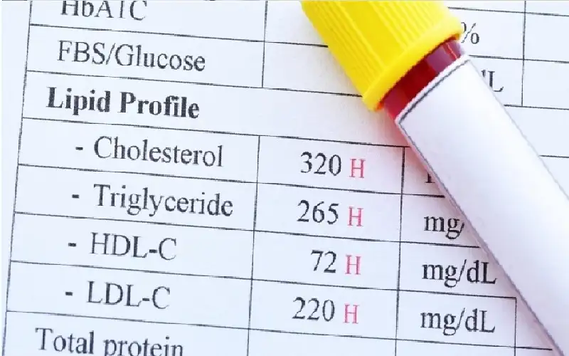 حقائق جديدة عن ارتباط الكوليسترول الجيد