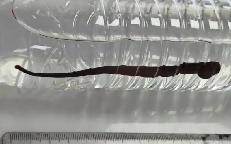 صدمة في المستشفى.. كائن حي يخرج