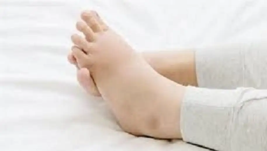 طبيب يوضح أسباب التورم