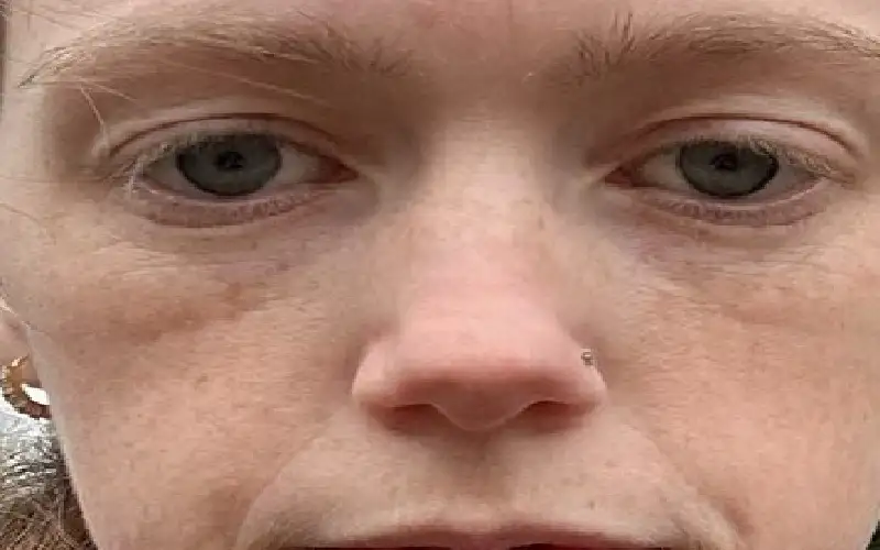 تتقيأ 60 مرة يوميا.. بريطانية تعاني