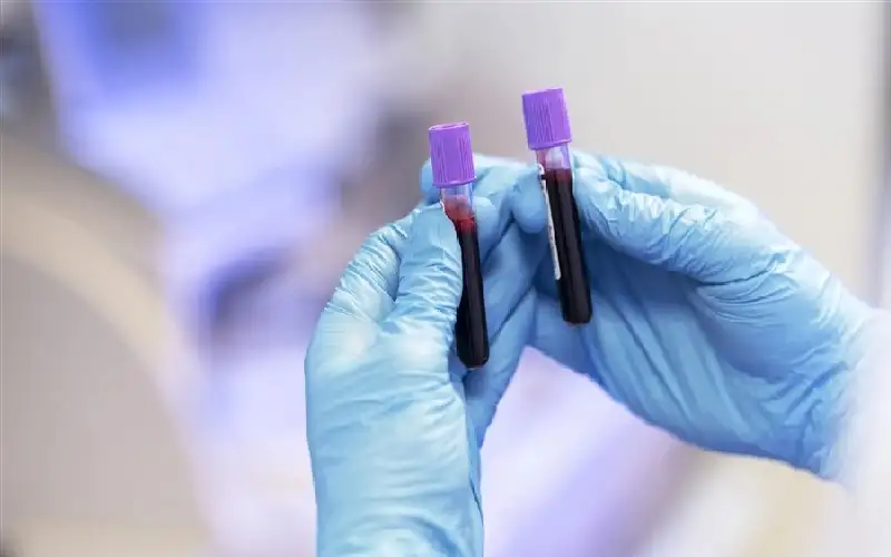 ما هو الورم البرولاكتيني؟