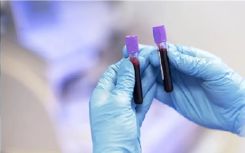 نصحية من ذهب لمرضى السرطان.. عليكم