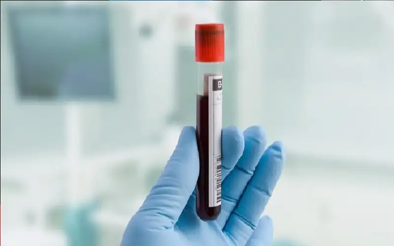 اختبار دم تجريبي يكشف سرطان القولون