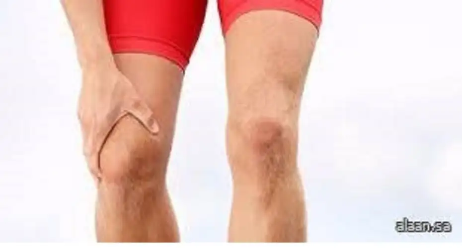 الروماتيزم يصيب الشباب بشكل متزايد