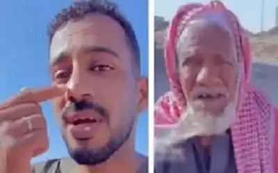 مسن يكوي أنف أحد أبنائه التوأم