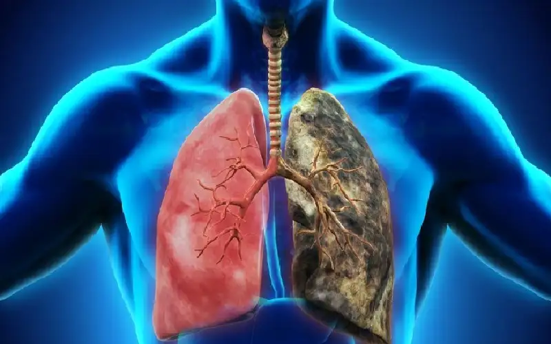 علماء يكشفون آلية الضرر الذي يسببه