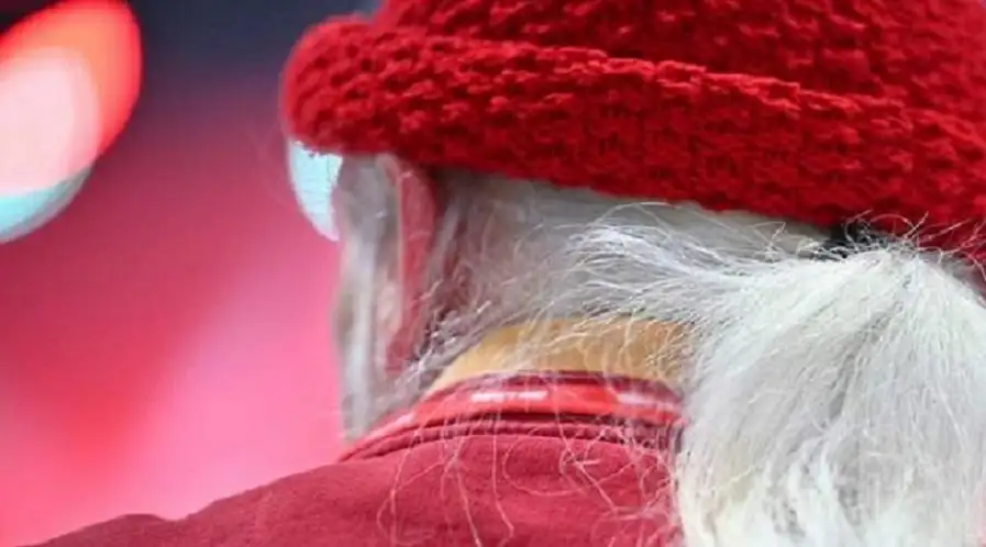 أسباب ظهور الشيب المبكر