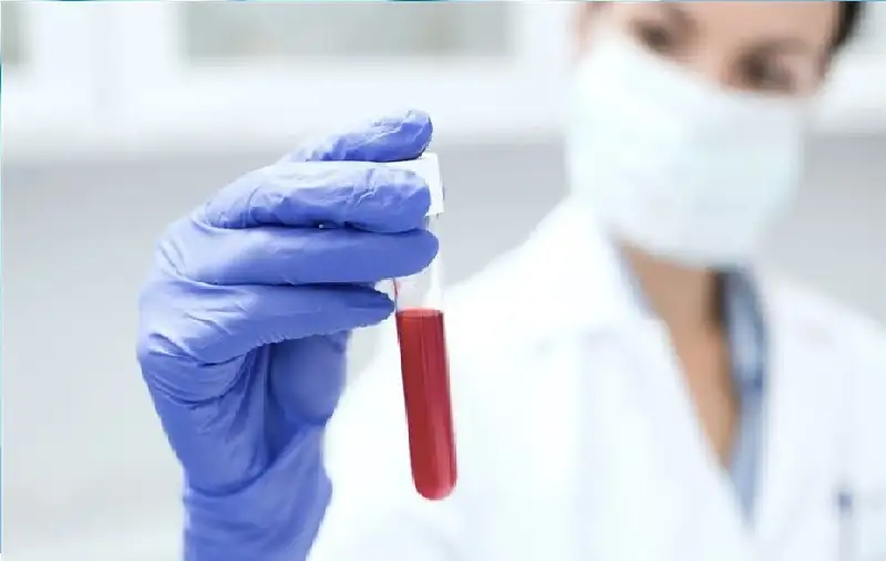 اختبار دم بسيط يكشف مبكرا سرطان