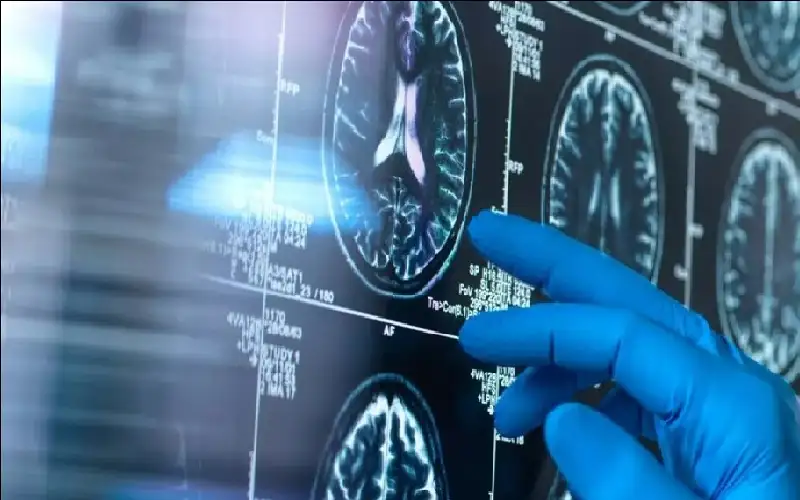 وجبة ملوثة تتسبب في إصابة أمريكية