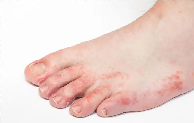 لا تتجاهلها أبدا.. أعراض يشير ظهورها