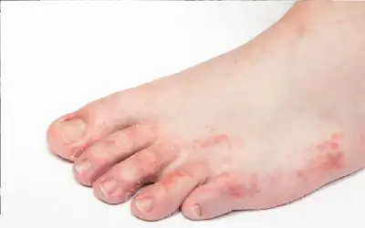 لا تتجاهلها أبدا.. أعراض يشير ظهورها