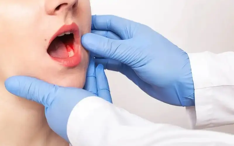 عيادة للكشف المبكر عن سرطان الفم