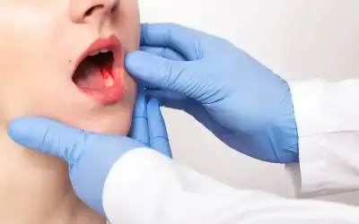 عيادة للكشف المبكر عن سرطان الفم