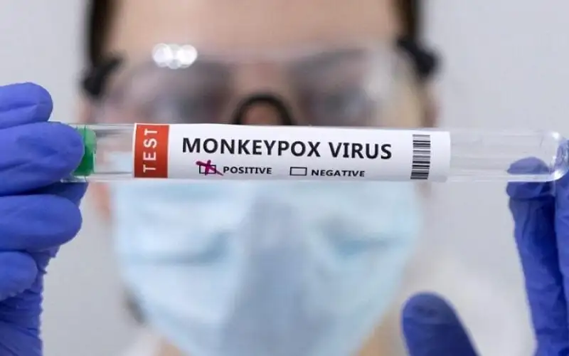 الصحة‭ ‬العالمية: جدري القردة ما زال