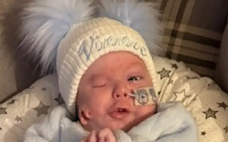 رضيع بريطاني بتشوهات نادرة.. أذن على