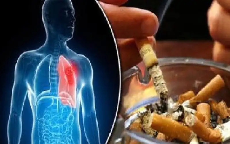 احذر الجلطات في رمضان.. نصيحة للمدخنين