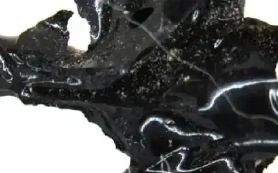 دماغ شاب تحول إلى زجاج.. اكتشاف