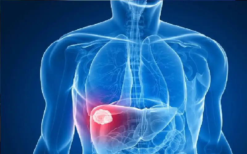 تطوير أداة ذكاء اصطناعي للتنبؤ بتكرار