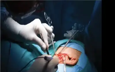 مرضى يسمعون أصوات أجسادهم.. جراحات متقدمة