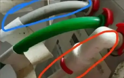 تشرب مياه الصرف الصحي لمدة 5