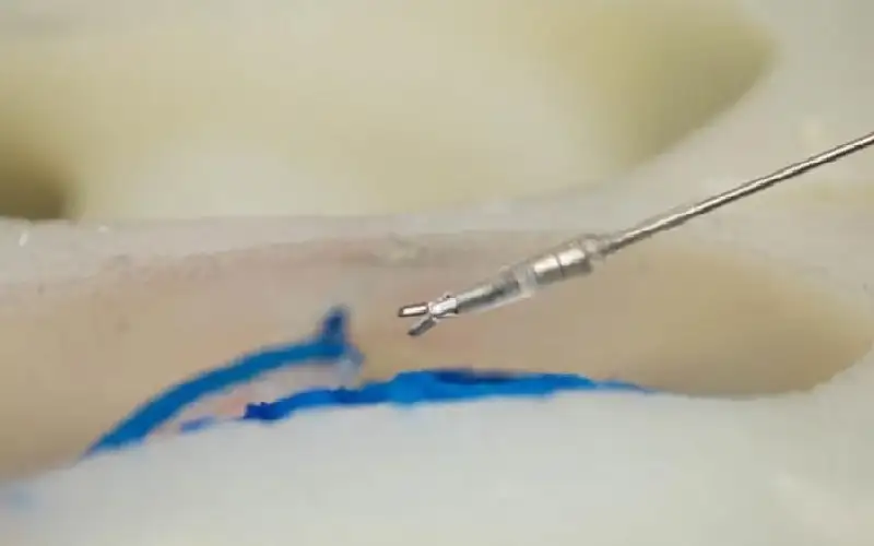 بنسبة نجاح 76%.. روبوتات دقيقة تنفذ